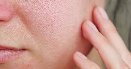 How to Naturally Shrink Your Pores